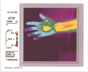 Mirotec thermography image 1
